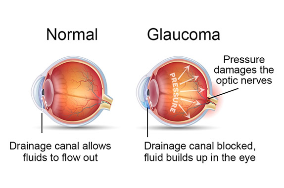 Best Optometrist